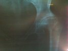 [Bonesmart.org] 8 days away