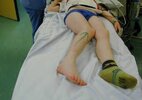 [Bonesmart.org] Dislocation?