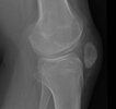 [Bonesmart.org] Some Xrays