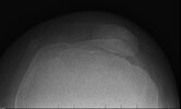 [Bonesmart.org] Some Xrays