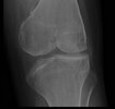[Bonesmart.org] Some Xrays