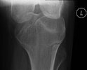 [Bonesmart.org] Some Xrays