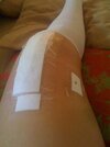 [Bonesmart.org] Op was off - and then on again!