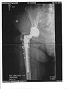 [Bonesmart.org] Nanamac's story - Part 2