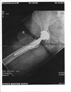 [Bonesmart.org] Nanamac's story - Part 2