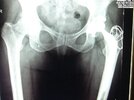 [Bonesmart.org] Nanamac's story - Part 2