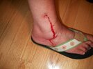 [Bonesmart.org] Nanamac's story - Part 2