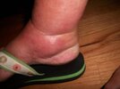 [Bonesmart.org] Nanamac's story - Part 2