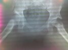 [Bonesmart.org] got great pics
