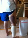 [Bonesmart.org] Scared but I made it!!!