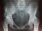 [Bonesmart.org] got great pics