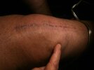 [Bonesmart.org] Will new knees be good enough?