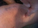 [Bonesmart.org] Will new knees be good enough?