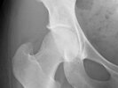 [Bonesmart.org] Almost a year!!