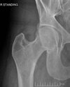 [Bonesmart.org] Almost a year!!