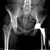 [Bonesmart.org] Cstreet on the other side