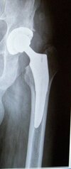 [Bonesmart.org] Almost a year!!