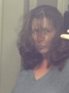 [Bonesmart.org] DallasSarah post op update!