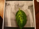[Bonesmart.org] On the other side in Seattle.