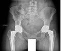 [Bonesmart.org] Almost a year!!