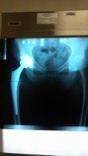 [Bonesmart.org] I'm New and Hurting!