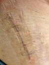 [Bonesmart.org] dduneriders Recovery