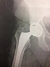 [Bonesmart.org] dduneriders Recovery