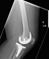 [Bonesmart.org] Revision Complete, recovery continues