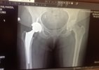 [Bonesmart.org] I MADE IT!!
