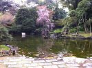[Bonesmart.org] Left hip resurfacing - Tokyo