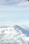 [Bonesmart.org] Left hip resurfacing - Tokyo