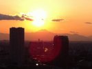 [Bonesmart.org] Left hip resurfacing - Tokyo