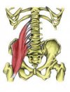 [Bonesmart.org] SeaSiren's sweet new hips!