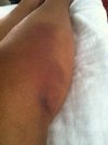 [Bonesmart.org] Help, my leg feels longer.....