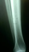 [Bonesmart.org] Brownie's Good, Bad, & Uglies