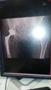 [Bonesmart.org] Some days are diamonds, some days are stone