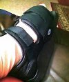 [Bonesmart.org] I have a new knee!