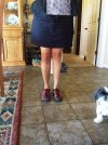[Bonesmart.org] How much do you tell to someone considering surgery?