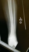 [Bonesmart.org] Brownie's Good, Bad, & Uglies