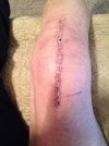 [Bonesmart.org] Never give up, keep trying, don't settle - that's me, Bonnie