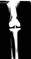 [Bonesmart.org] Never give up, keep trying, don't settle - that's me, Bonnie