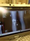 [Bonesmart.org] Class of 2010, 2011, 2012, 2013 Knee Members