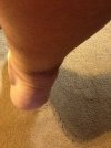 [Bonesmart.org] My Journey as of 12/16/13 - Over 1 Year and Still Trying