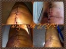 [Bonesmart.org] Jozilla Part 2 - 9/8/14 LTKR
