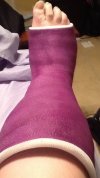 [Bonesmart.org] Story of My Knees by RestAssured: Pt 3