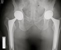 [Bonesmart.org] A thank-you and an introduction