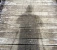 [Bonesmart.org] Bill's Bionic Breakdown