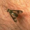 [Bonesmart.org] Z's Postop thread