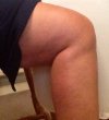 [Bonesmart.org] My Journey as of 12/16/13 - Over 1 Year and Still Trying