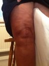 [Bonesmart.org] My Journey as of 12/16/13 - Over 1 Year and Still Trying